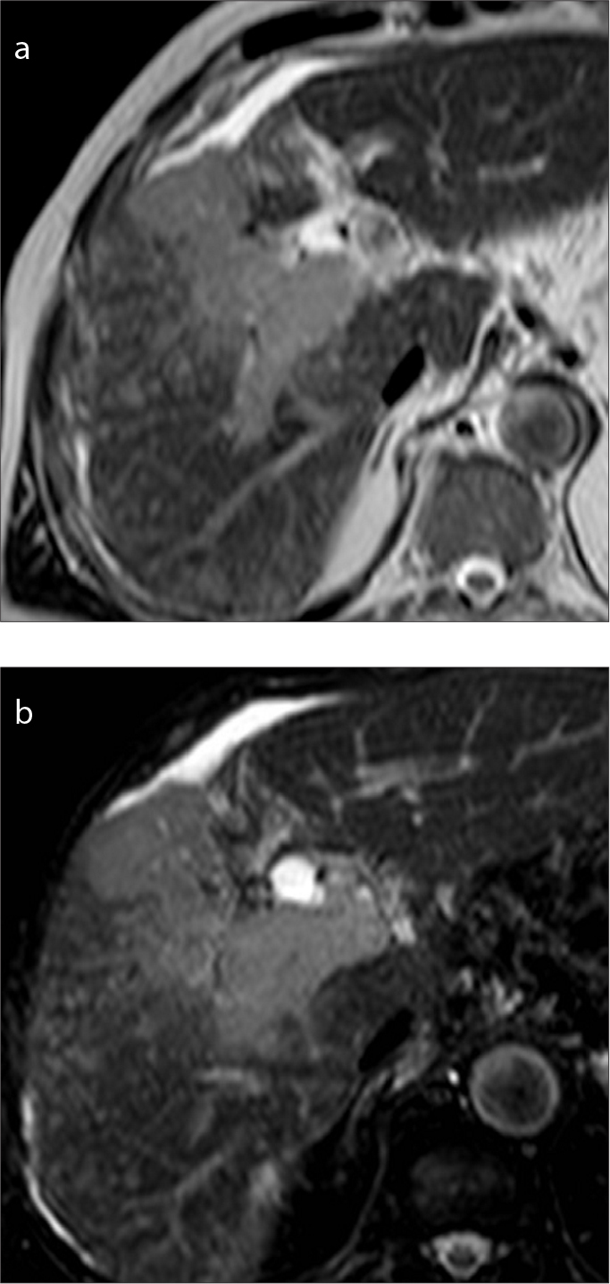 Figure 14. a, b