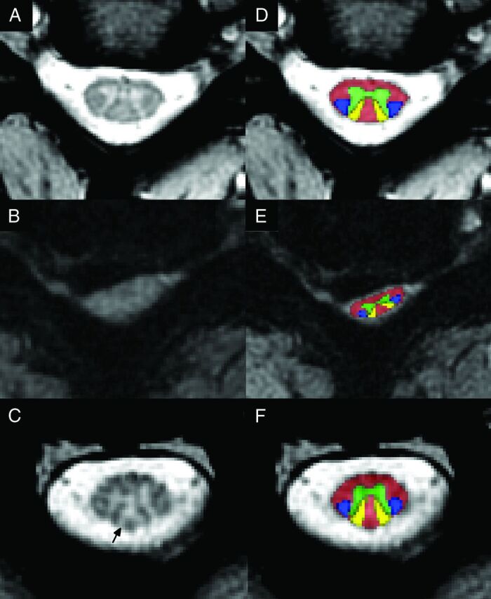 Fig 2.