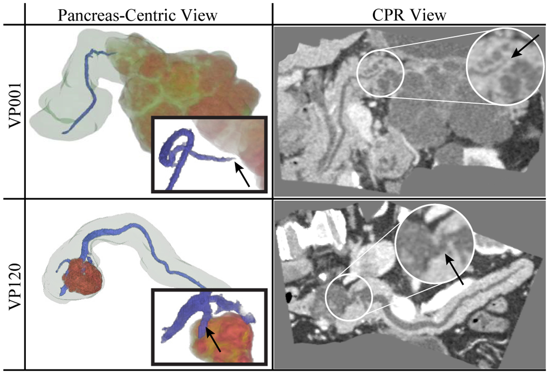 Fig. 11.