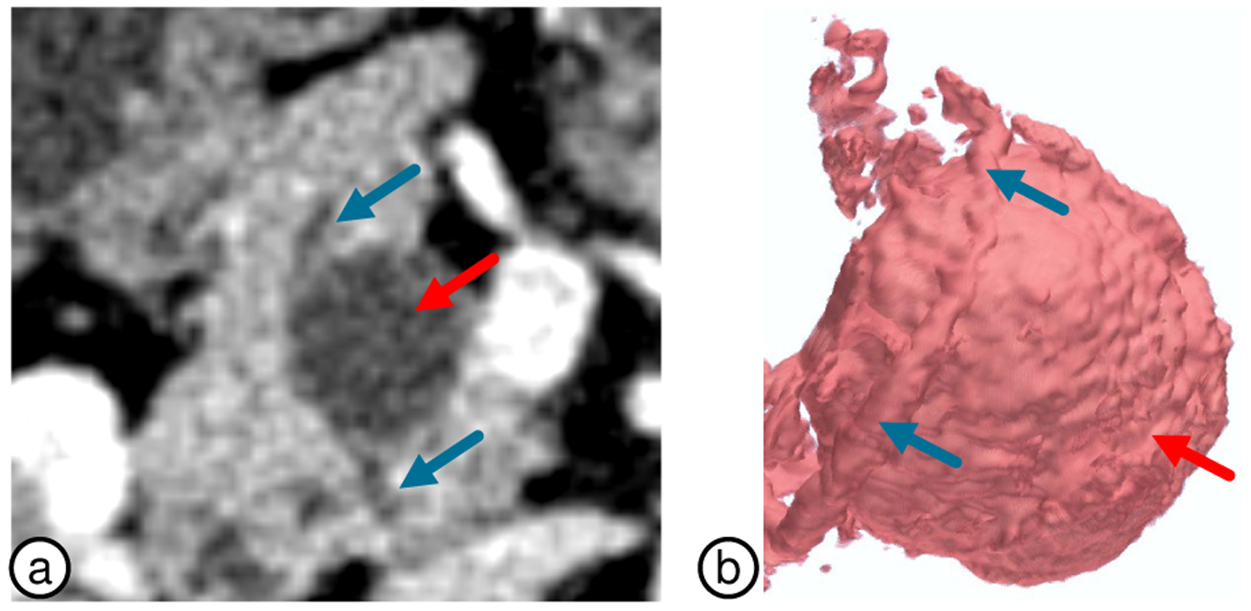 Fig. 15.