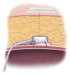 Fig 12