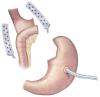 Fig 16