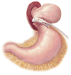 Fig 10