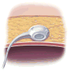 Fig 13