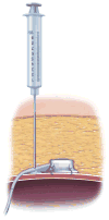Fig 14