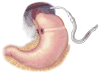 Fig 11