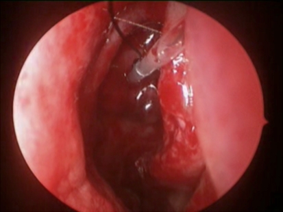 Fig. 9