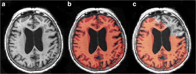 Fig. 3