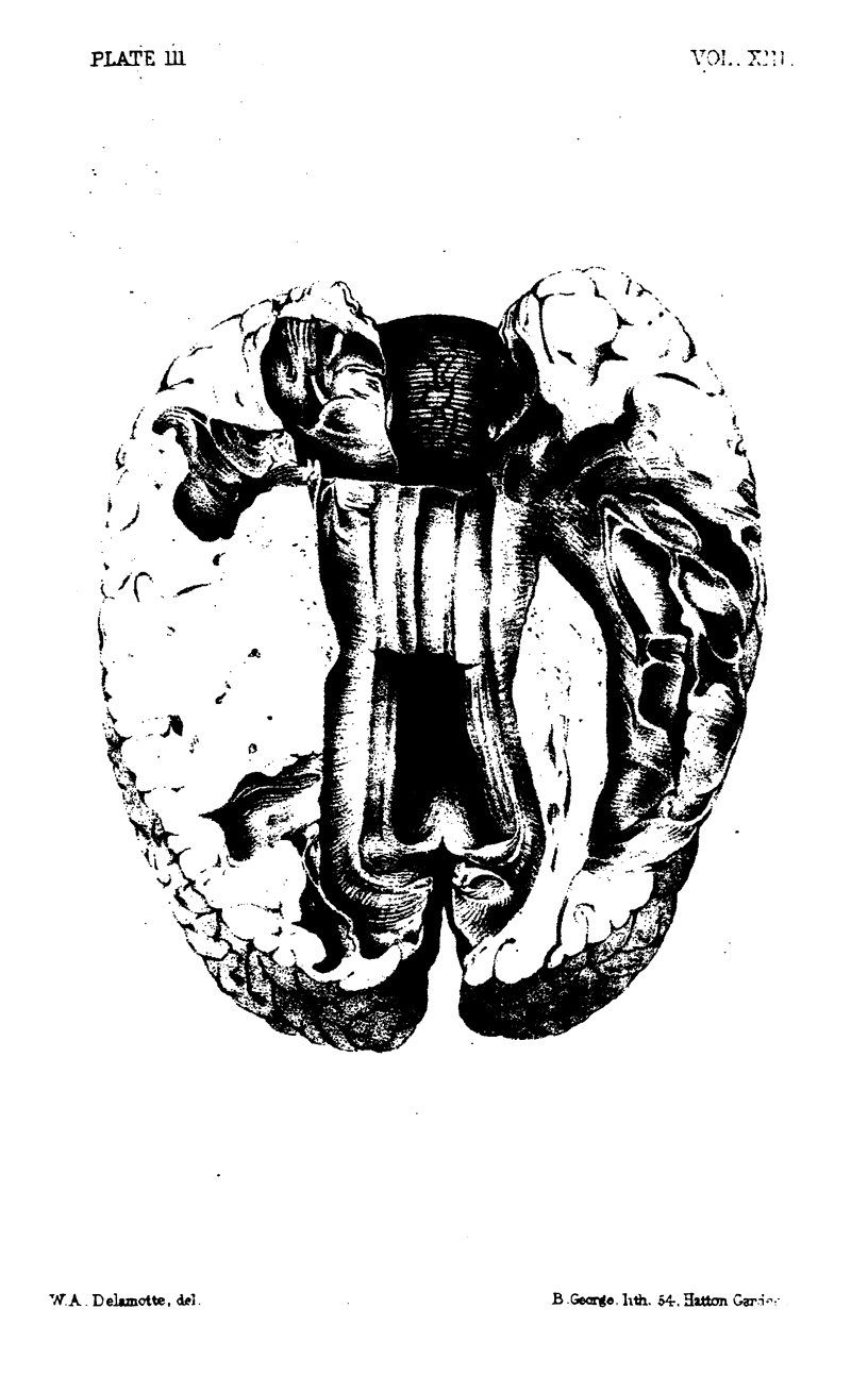 244-1