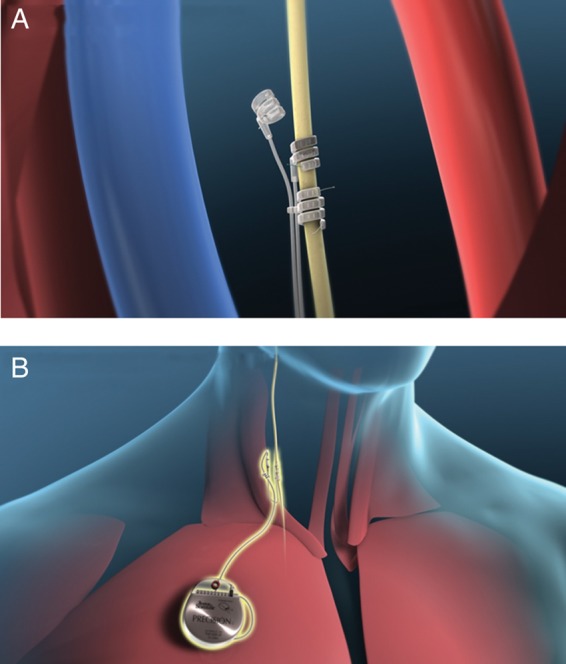 Figure 2