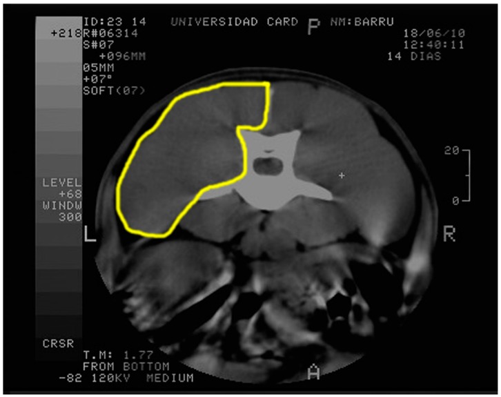 Figure 2