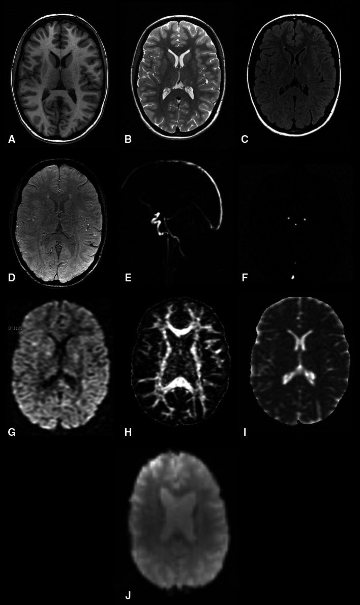 Fig. 2