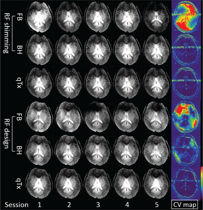 Fig 3.