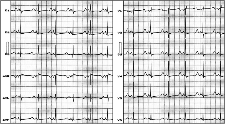 Fig. 4