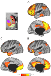 Fig. 11.