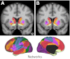 Fig. 14.