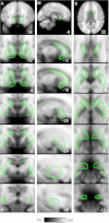 Fig. 3.