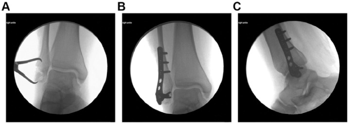 Figure 3.