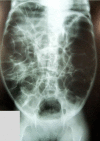 Figura 2