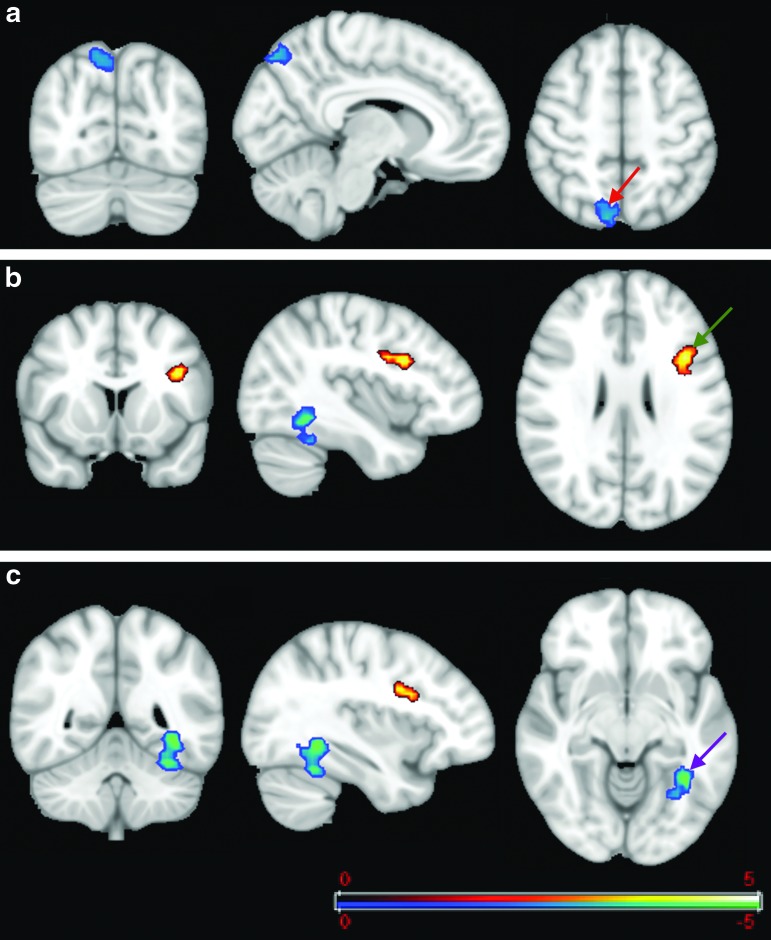 FIG. 11.