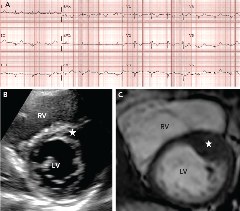 Figure 2: