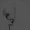 FIG. 5.