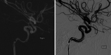 FIG. 4.
