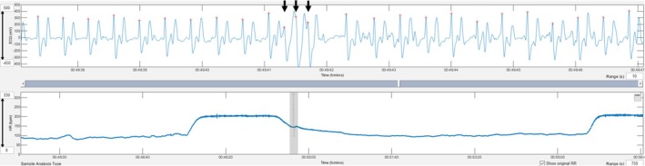 FIGURE 3