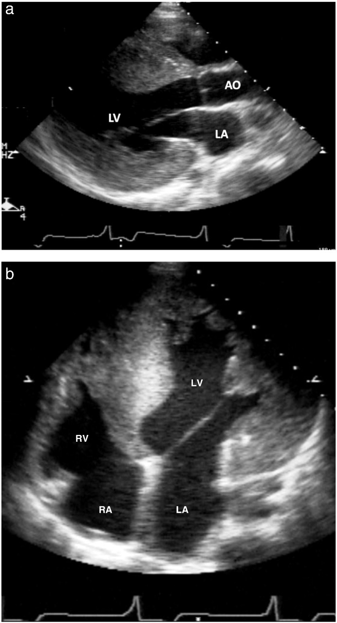 Fig. 1