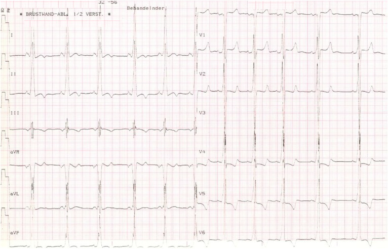 Fig. 1