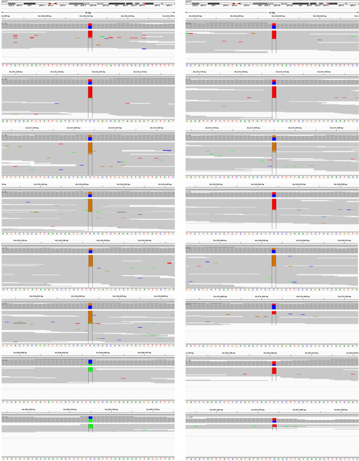 Figure 3—figure supplement 1.