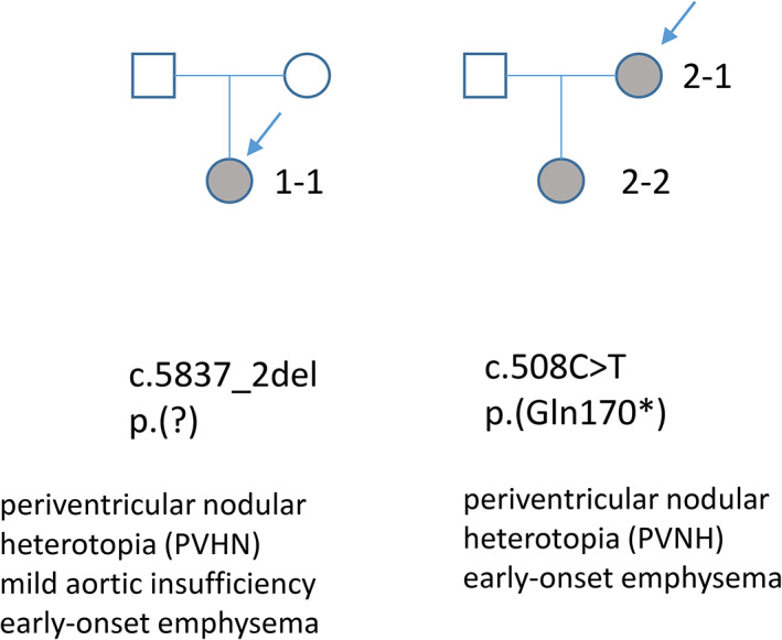 FIGURE 1