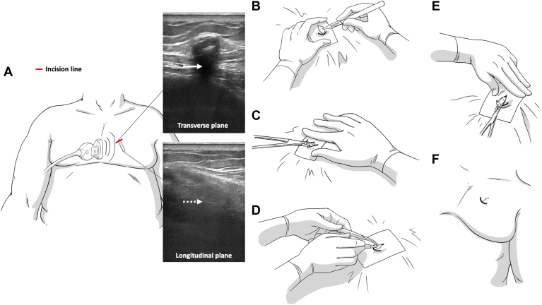 Figure 1