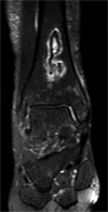 Figure 4.Coronal