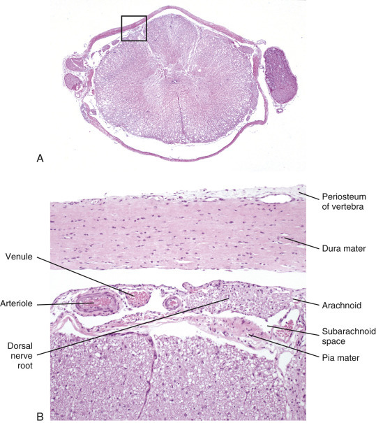 Figure 14-15