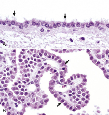 Figure 14-12