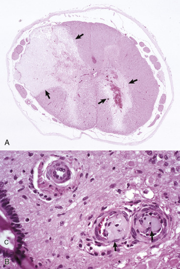 Figure 14-62