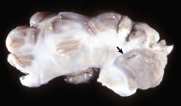 Figure 14-29