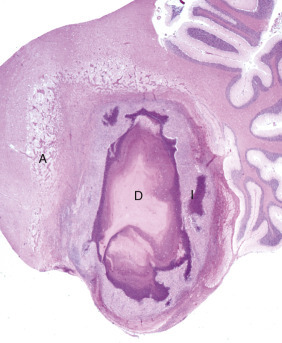 Figure 14-9