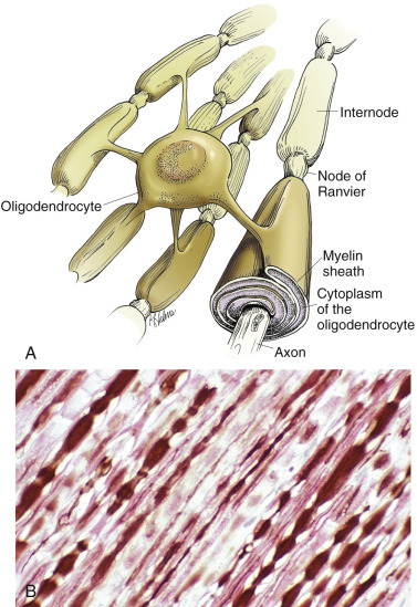 Figure 14-11