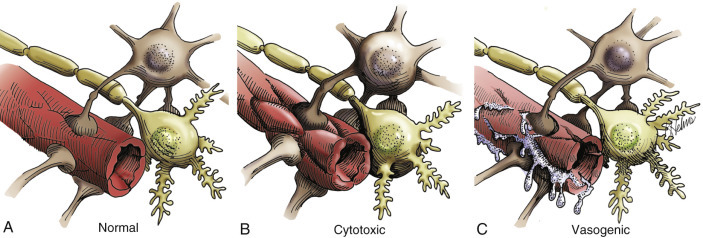 Figure 14-26