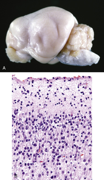 Figure 14-34