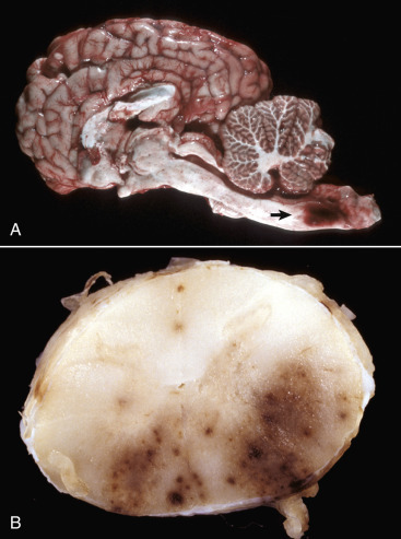 Figure 14-81