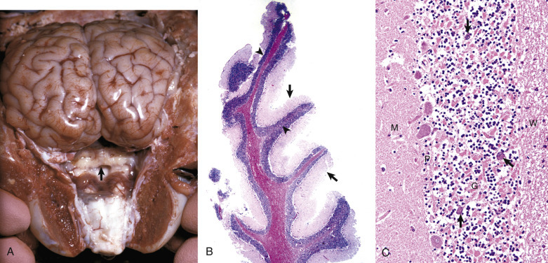 Figure 14-36