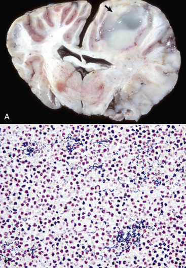 Figure 14-41