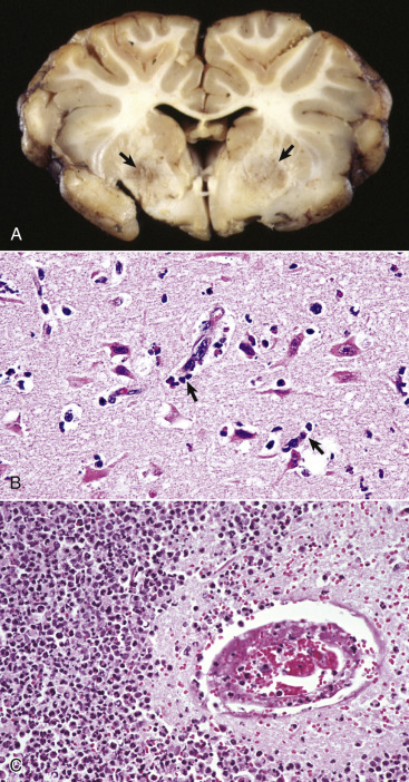 Figure 14-96