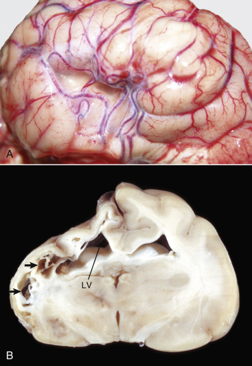 Figure 14-107