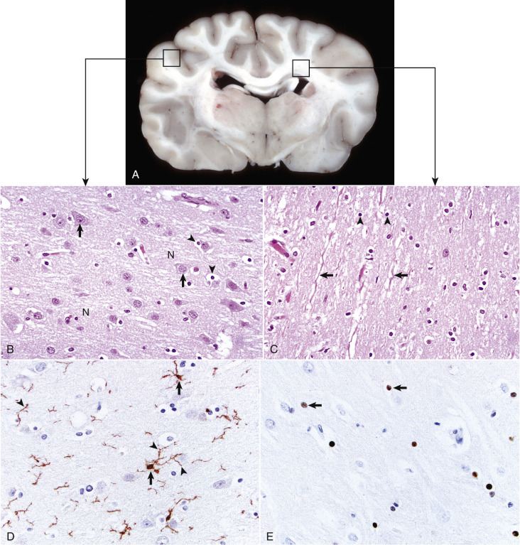 Figure 14-1