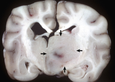 Figure 14-72