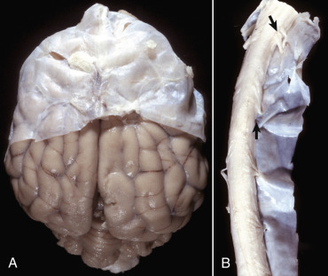 Figure 14-14